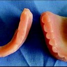 pt-Cast Denture Pour Technique