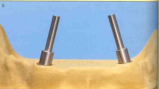 slide 6